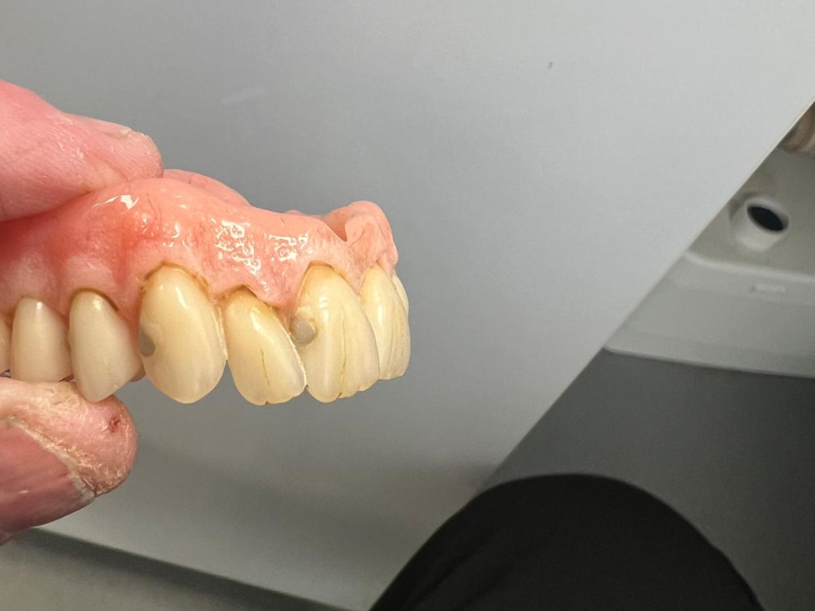 Senior Patient Denture